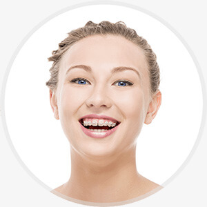 a girl smiling with one of the braces options at JKO