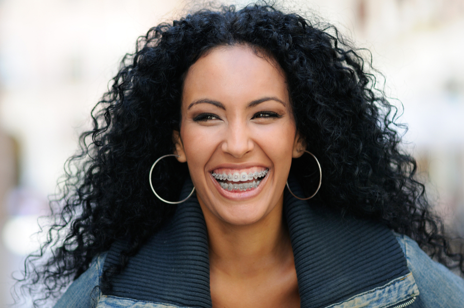 woman-smiling-wearing-braces-on-teeth