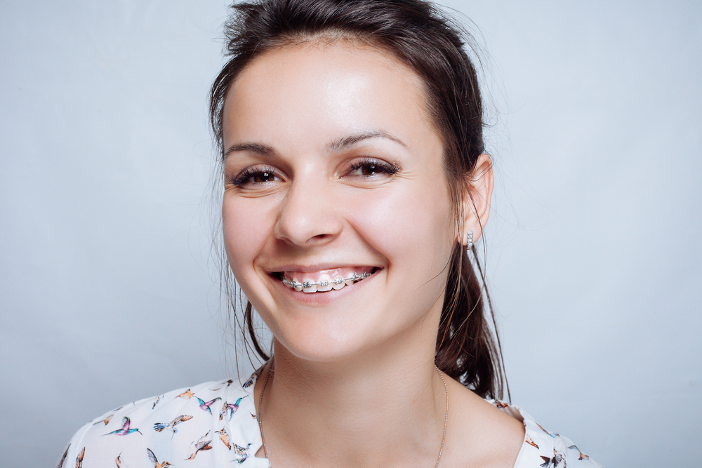 girl-smiling-during-her-life-with-braces-at-el-dorado-hills