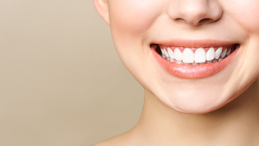 What Can Rubber Bands Do for My Bite? - iSmile Orthodontics