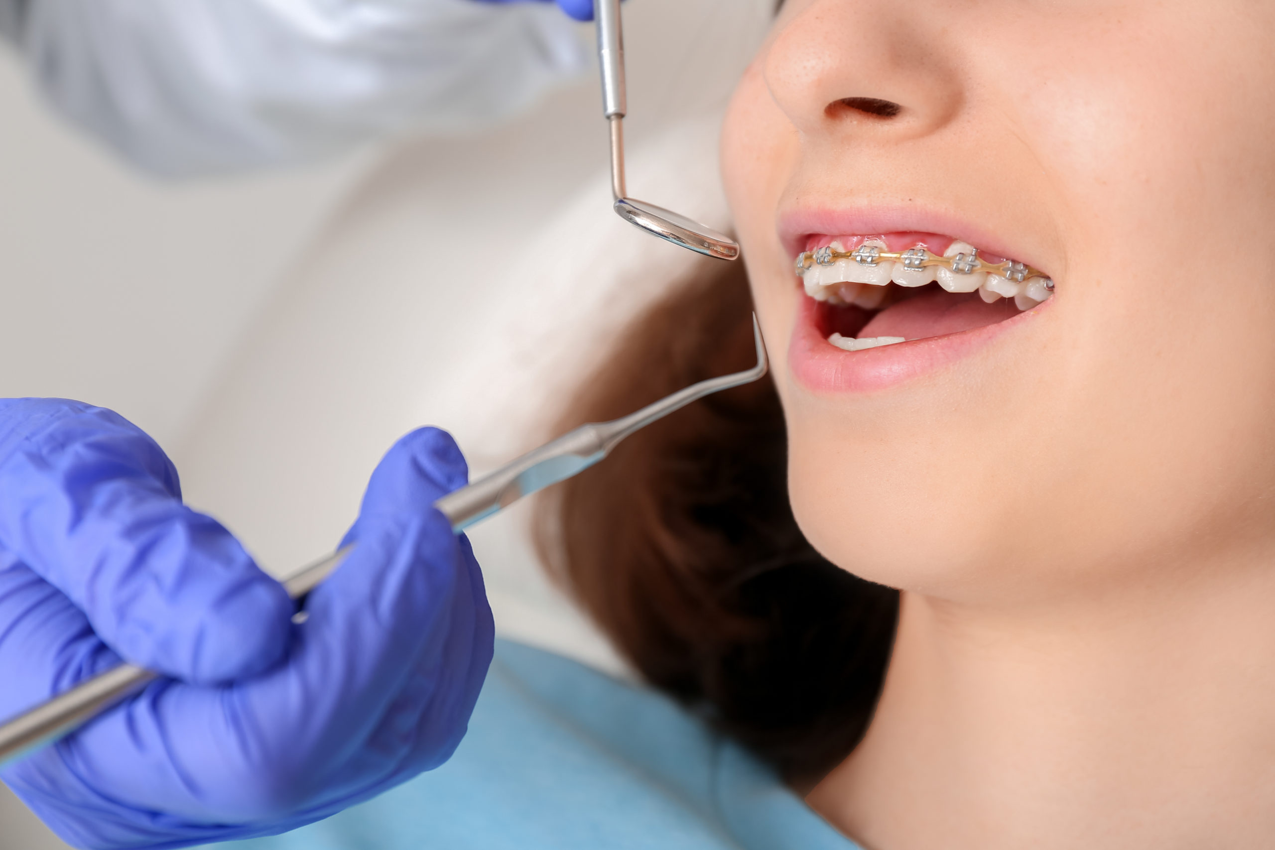 Kids Braces  Why is Early Dental Intervention Important?