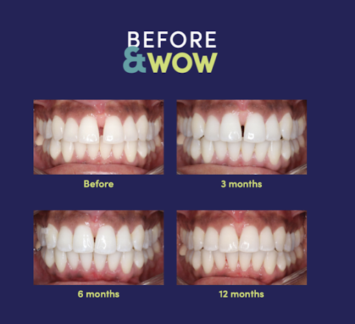 Before & WOW