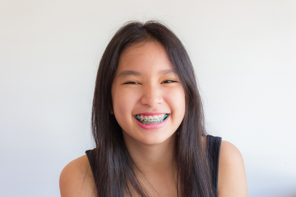 8 Common Questions About Phase 1 Orthodontics