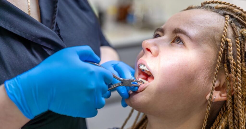 An orthodontist adjusting a patient's braces after they finished with their palate expander