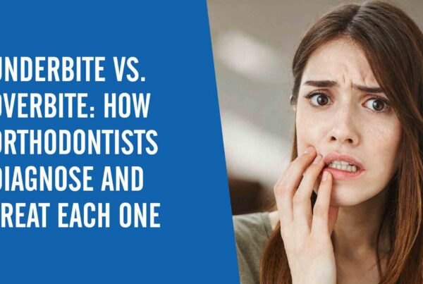 A woman holding her face with a text overlay that says "Underbite vs. Overbite: How Orthodontists Diagnose and Treat Each One"