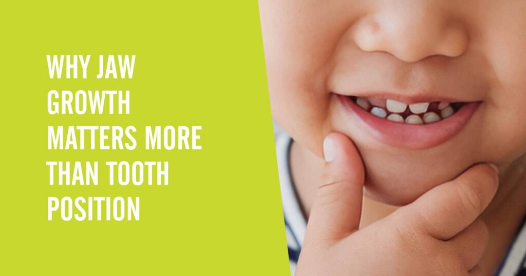 A child holding their chin against a green background with a text overlay that says "Why Kids' Jaw Growth Matters More Than Tooth Position"