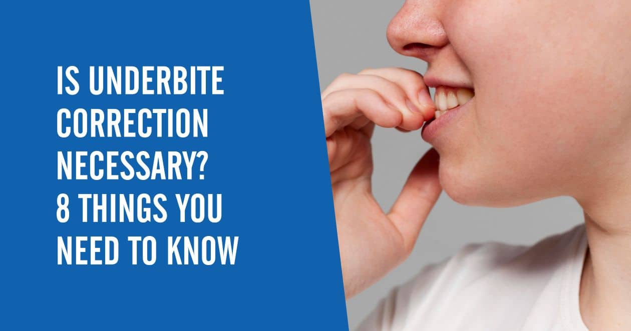 A side view of a person smiling and putting their fingers on their teeth with a text overlay that says "Is Underbite Correction Necessary? 8 Things You Need to Know"